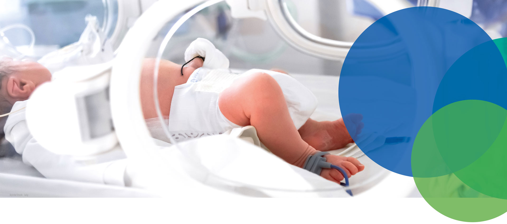 Ein neugeborenes Baby in einer Windel liegt in einem Inkubator in einem Krankenhaus, wobei medizinische Geräte zu sehen sind. Blaue und grüne durchscheinende Kreise verdecken teilweise die rechte Seite des Bildes.